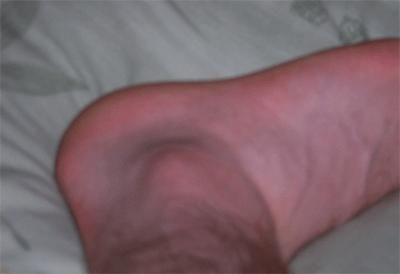 my left ankle